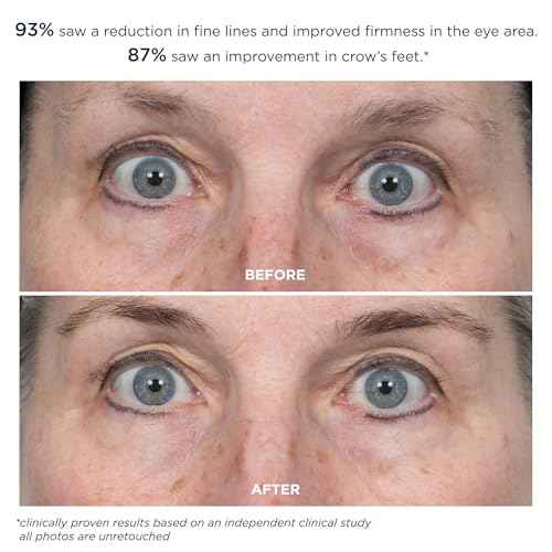 m-61 ProSmooth Retinol Eye Serum | 0.1% Non-Irritating Retinol Eye Serum with Vitamin C, 0.5 Fl Oz