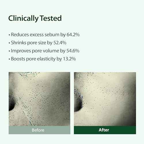 BLITHE Targeted Pore Serum with 22% Niacinamide for Oil Control, Pore Minimizer for Face, Korean Skin Care ? 1 fl oz