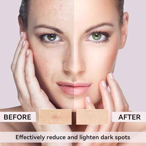 Dark Spot Remover for Face, Dark Spot Corrector for Age Spot Sun Spot Brown Spot Melasma Uneven Skin Tone, with Vitamin C and Hyaluronic Acid for Women and Men, 1.7 FL OZ