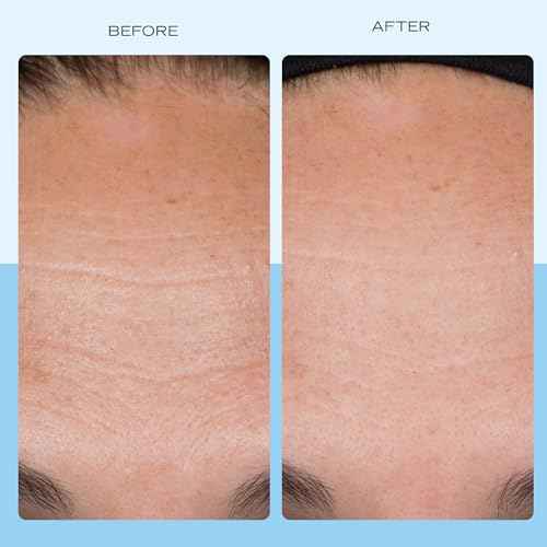 First Aid Beauty - Firming Collagen Cream with Peptides & Niacinamide, Ultra-Rich Plumping Moisturizer, Hydrates & Visibly Firms, Non-Comedogenic, Safe for Sensitive Skin, 3.5 oz