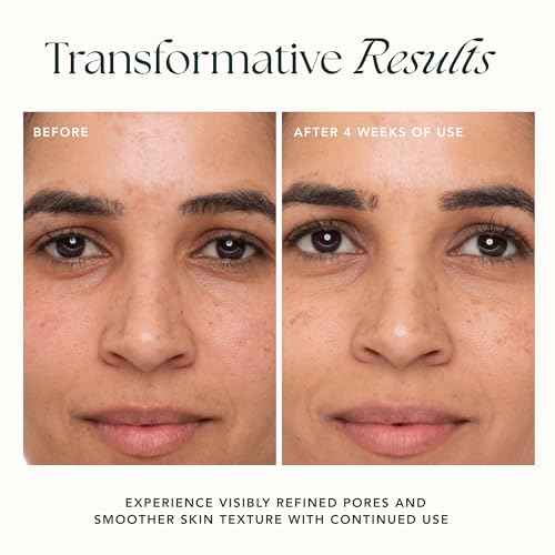 RANAVAT Refining Lotus Gel Cream - Hydrating Gel Moisturizer & Pore Minimizer ? Improves Radiance & Texture with Hyaluronic Acid & Floral Ketoacids (1.7 oz)