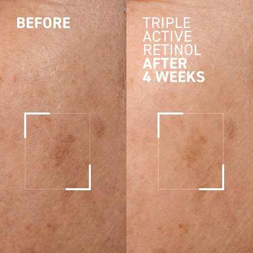 Dr. Brandt Skincare BTW Triple active retinol gentle overnight renewal cream 1 fl. oz. / 30 ml