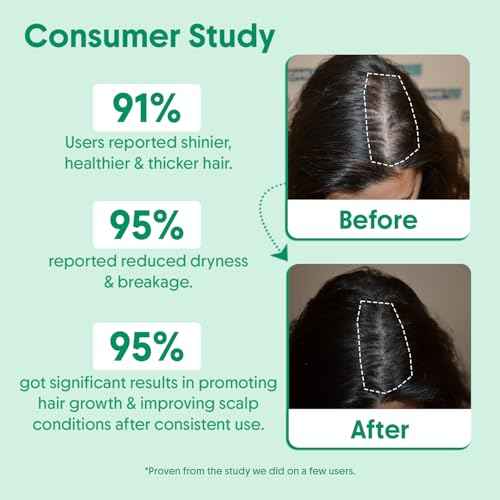 Aravi Organic Rosemary Water Hair Spray with Aloe Vera & Rice Water | Stimulates Hair Follicles, Boosts Hair Growth & Thickness, Reduces Hair Fall, Breakage & Dandruff | For Men & Women - 100ml