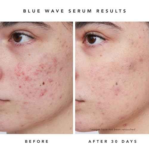 HERBIVORE Blue Besties Duo ? 2-Step Treatment for Acne-Prone Skin, Aquarius Cleanser (50 mL) & Blue Wave Serum (10 mL), Plant-Based, Vegan, Cruelty-Free