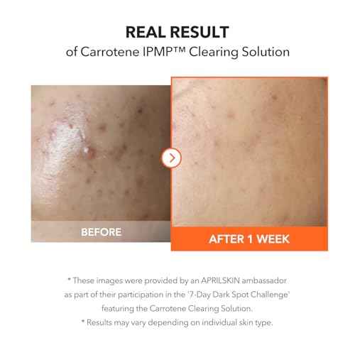 APRILSKIN Carrotene IPMP¢â Clearing Solution || Quickly soothes troubled areas and helps clear blemishes | Formulated with BHA, AHA, Niacinamide & Zinc Oxide | Vegan, Cruelty-Free (0.67fl.oz.)