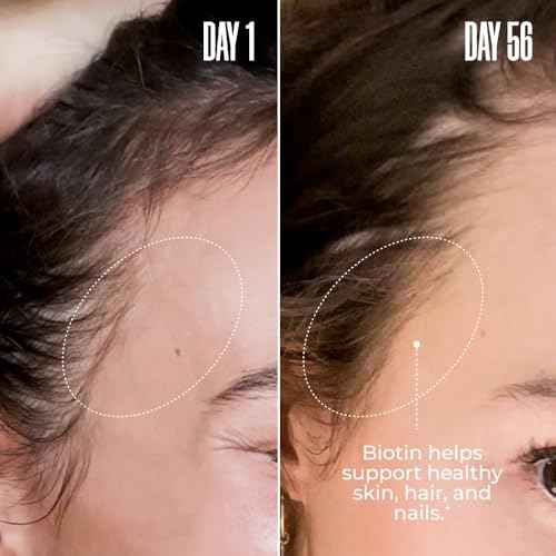 MA?LYS Super Charged Liquid Collagen for Women - Collagen Peptides Supplement with Biotin for Hair, Skin and Nails - Liquid Hydrolyzed Collagen Peptides