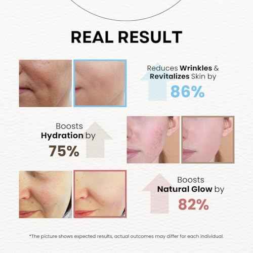 MPC Stem Cell Moisturizing Cream ? Anti-aging, Wrinkle Care, Skin Regeneration. Firming, Deep Hydration, Face Moisturizer with Caviar, Niacinamide and Peptides, Korean Skin Care 3.38 fl oz