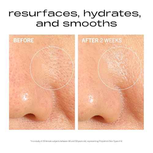 MATTER OF FACT Resurfacing + Hydrating Serum, Multi-Acid Blend with Niacinamide for Deep Hydration, Refined Texture and Clarity, 30mL / 1.0 Fl Oz