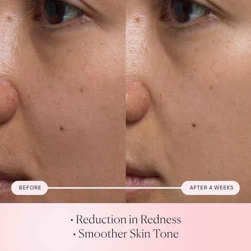 ELEMIS Pro-Collagen Rose Micro Serum | Hydration serum that plumps, soothes, and nourishes your skin while reducing fine lines & wrinkles.