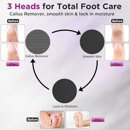 Electric Foot Callus Remover, Apply Oil,Electric Foot File,Reusable Nano-Glass Head, Ergonomic Electric Callus Remover for feet, Rechargeable Pedicure Tools for Feet