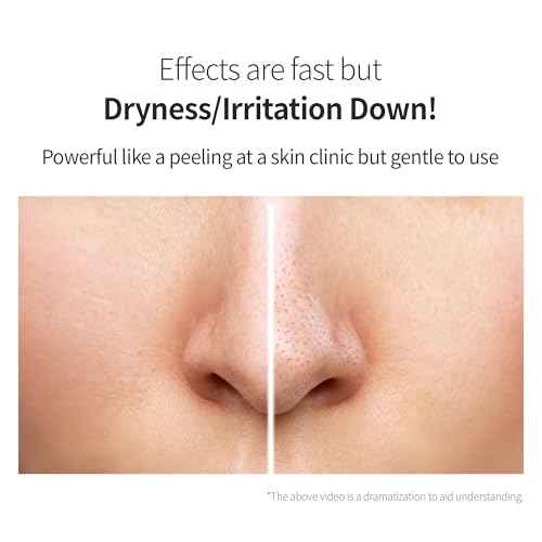 Benton Glycolic Acid 7% Exfoliating Toner with Niacinamide - Gentle AHA Toner for Brighter Skin & Even Tone - Balances Oil & Moisture - Hydrating, Cruelty-Free Korean Skin Care