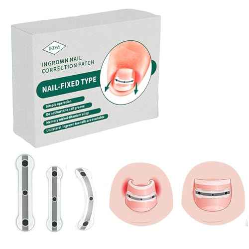 Ingrown Toenail Treatment & Removal Kit - at Home Treatment for Ingrown Toenails, Titanium Alloy Ingrown Toenail Corrector, Nail Tools for Curved Nail Repair Suitable for Men Woman (((0.67/0.79in)))