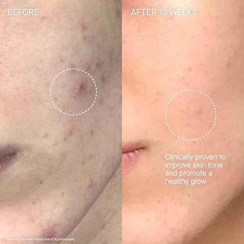 Augustinus Bader The Cream ? Luxury Face Cream ? Hydrating and Nourishing Face Moisturizer ? Facial Moisturizer for Wrinkle Reduction and Cellular Renewal ? For Men and Women