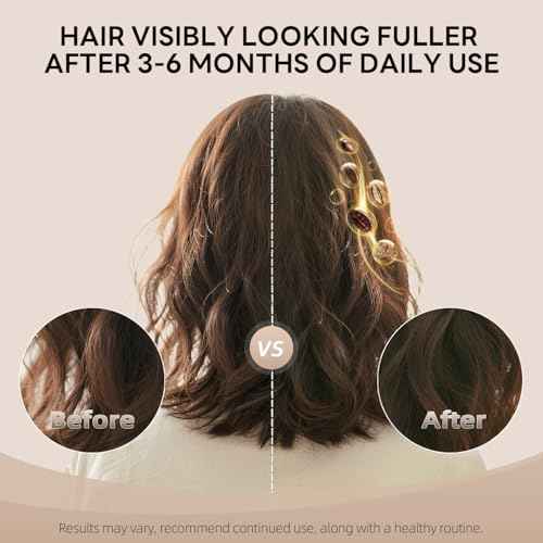 ALFHEIM Coffee+ Thickening Conditioner for Fine, Thin & Weak Hair with Caffeine, Biotin & Arabica Coffee Oil, Strengthening, Moisturizing & Volumizing Formula, Paraben-Free, Sulfate-Free, 33.8 oz 1L