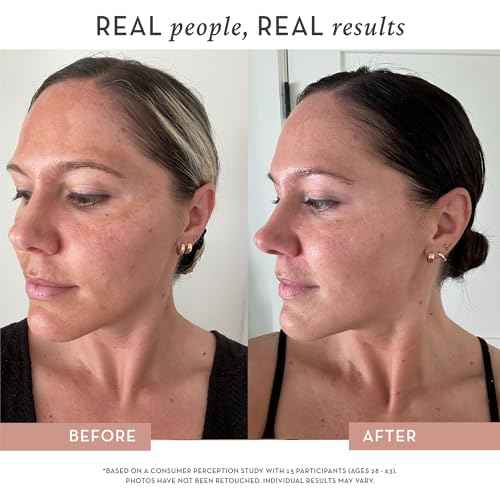Vitamin C Serum for Face ? All-in-One Formula ? Profesional Grade AAP & THD, Peptides, 3X Hyaluronic Acid ? For Sensitive Skin ? Brightens, Firms & Hydrates ? 1 oz