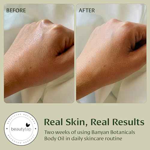 Banyan Botanicals Body Oil ? Lightweight & Non-Greasy Body Oil ? Ayurvedic Skin Care with Organic Jojoba Oil & Herbs for Soft, Smooth Skin ? 4 oz ? Non-GMO, Cruelty Free, Paraben Free Massage Oil