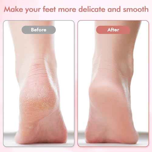 Electric Foot File and Callus Remover,Professional Pedicure Tools for Dry, Calluses, Dead, Cracked, Hard Skin,Equipped with 2 Grinding Heads and 1 Cleaning Brush