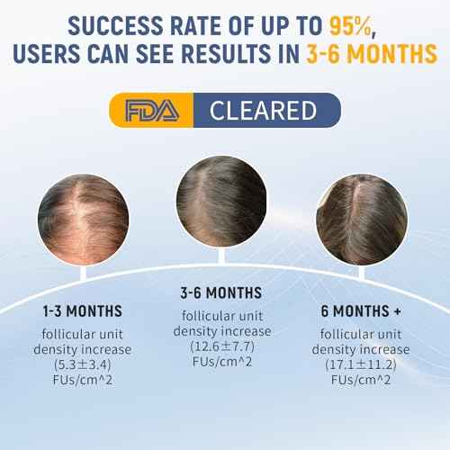 Laser Therapy Hair Growth Comb, Home Use Red Light Device, Rechargeable, Laser Hair Growth Treatment for Men and Women