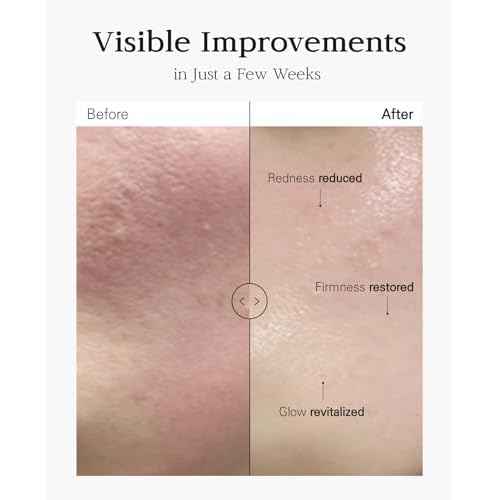Nuborn Cell Placenta Stem Cell Intensive Repair Cream | Dragon Blood Cream with Placental Extract | Collagen Korean Skin Care for Glass Skin (50ml)