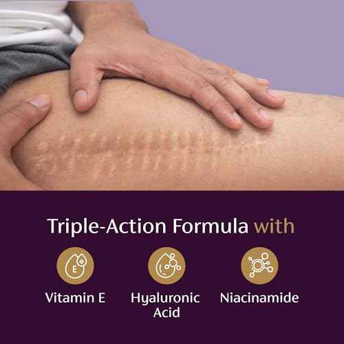 Mederma Scar Serum ? Triple-Action Formula with Vitamin E, Hyaluronic Acid & Niacinamide ? Clinically Shown to Reduce Old Scars, 1 Fl. Oz.