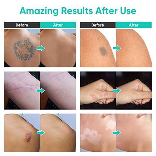 Tattoo Cover Up Makeup, 2 Colors Waterproof & Sweatproof Tattoo Cover Up Makeup, Long Lasting and Invisible Body Makeup Suitable for Vitiligo, Dark Spots, Scars-Natural