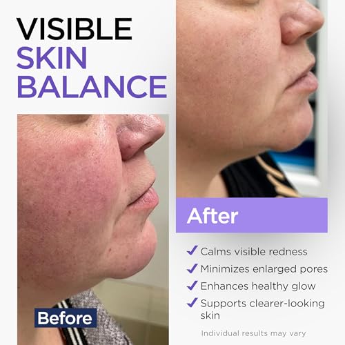 Niacinamide Serum for Face 10% with Zinc 1% Vitamin B3 Anti-Aging, Advanced Skin Care for Even Tone, Texture and Hydrating Cruelty Free 2 Oz