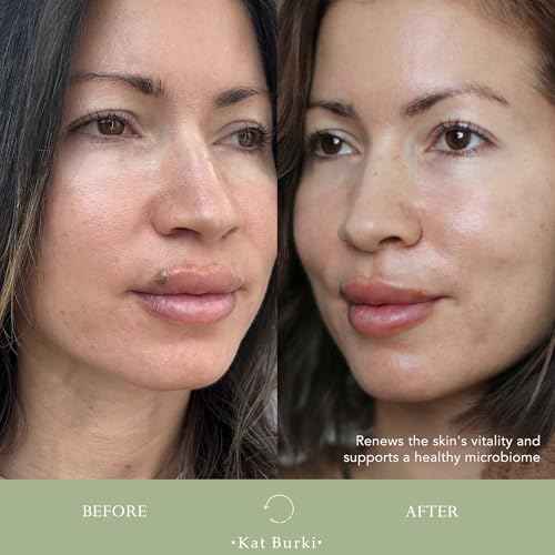 Kat Burki pH+ Enzyme Essence Face Serum, Balancing and Smoothing with Pumpkin and Papaya Enzymes, Turmeric, Licorice Root, and KB5 Complex, 3.4 Fl Oz
