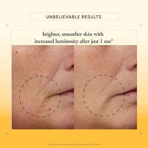 philosophy microdelivery vitamin c resurfacing peel kit - with lactic acid & sunflower seed oil - two-step treatment to smooth rough texture, even skin tone and minimize the appearance of fine lines
