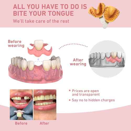 Custom Partial Dentures ? Personalized Removable Denture Set for Missing Teeth | 1?6 Tooth Replacement with Storage Case | Natural Look & Comfortable Fit (1 Tooth)