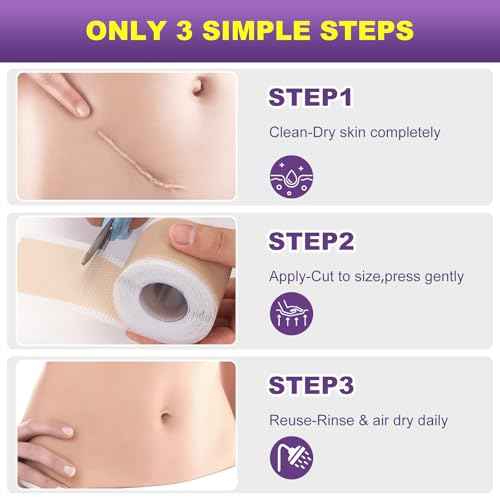 Silicone Scar Sheets, Silicone Scar Tape, Scar Tape for Keloid Bump Removal, Reusable Silicone Scar Strip for C-Section, Keloid, Surgery, Burns, Acne Scar et(1.8¡±x157¡±Roll-4M)