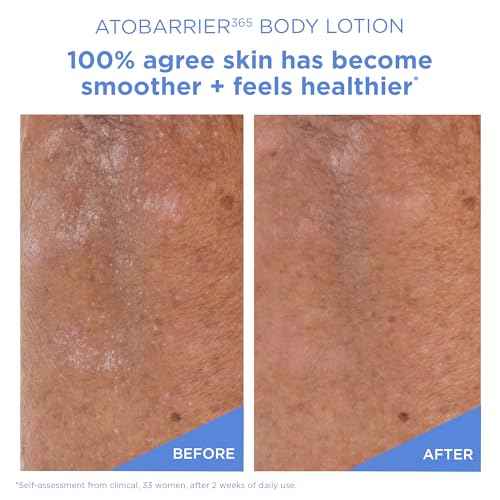 AESTURA ATOBARRIER365 Korean Body Lotion with Ceramides | Fast-Absorbing Moisturizer for Dry, Sensitive & Eczema-Prone Skin | Non-Comedogenic, Fragrance-Free, 400 mL / 13.5 fl oz