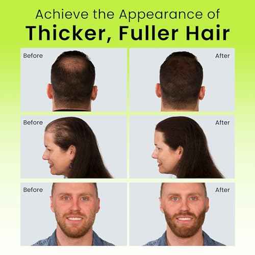 ECLIPSE Hair Fibers Medium Brown for Thinning Hair for Women & Men to Conceal Hair Loss in 15 Seconds - 100% Undetectable Hair Building Fibers, 60g