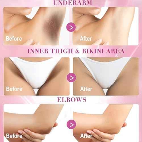 Skin Lightening Cream, Dark Spots Remover for Body Even Toning, Effectively Whitening Women Intimate Areas, Bikini Line, Underarms, Knees, Elbows, Renew Complexion and Replenish Skin Barrier
