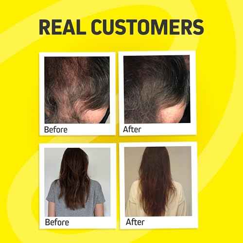 Hair Growth Vitamins for Women & Men | DHT Blocker with Saw Palmetto & 10000mcg Biotin, Foli Tonic Hair Growth Supplement ? Supports Fuller, Thicker Hair Appearance, Non-GMO, 120 Vegan Capsules