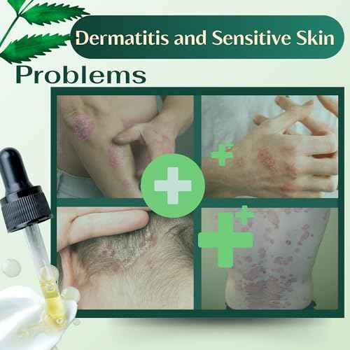 ABERA Alan Silver Serum ? Gentle Botanical Formula for Dry, Flaky Scalp and Sensitive Skin ? Enhances Skin Comfort and Moisture Balance ? Lightweight, Non-Greasy Texture ? Bonus Gift Included