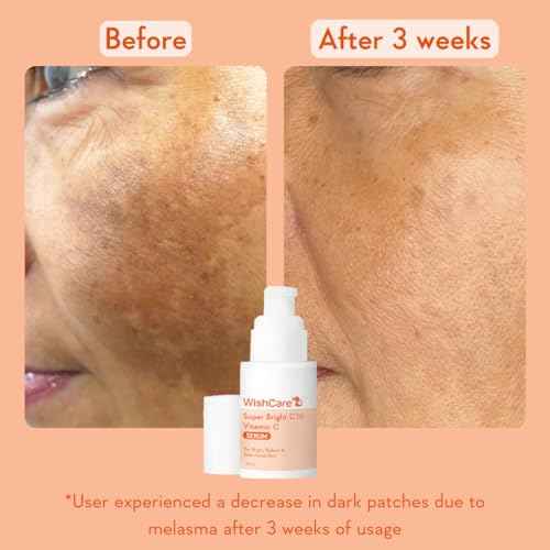 WishCare Vitamin C Face Serum with Niacinamide, Ferulic Acid & Botanical Extracts ? Serum for All Skin Types, 30ml