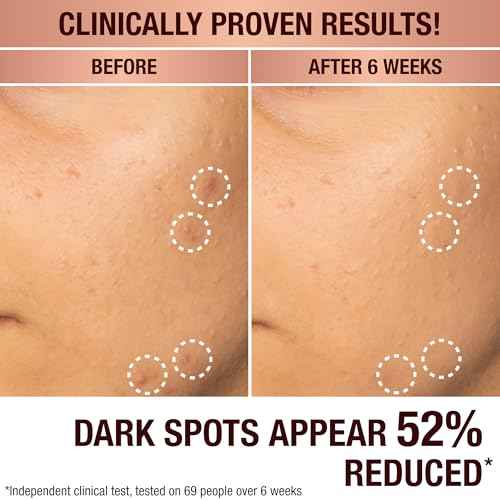 Charlotte Tilbury Radiance Recovery Dark Spot Serum - Dark Spot Corrector & Vitamin C Serum for a Brighter-Looking Complexion - Helps Reduce the Appearance of Redness & Uneven Skin Tone