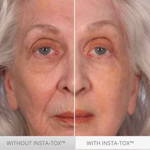 Serious Skincare INSTA-TOX Instant Wrinkle Smoothing Skin Serum TRIO - Temporarily Tightens Face - Instantly Reduce Appearance of Lines, Wrinkles & Large Pores - For Women & Men - .75 Fl. Oz. (3Pack)