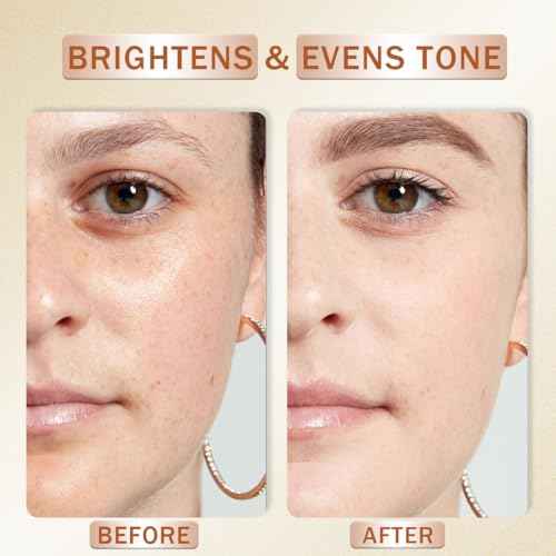 Vitamin C Serum for Face with Hyaluronic Acid, Boost Skin Collagen, Brightening, Antioxidant, Anti-Aging, Hydrate & Plump, Improve Appearance of Dark Spots, Tone, Fine Lines Facial Serum 30ml/1 fl oz