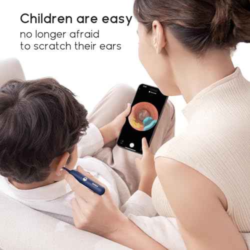 BEBIRD Official Original Accessory Only for Earsight Plus or R1 Ultra- 14 PCS Replacement Tip for Wet/Dry Wax Cleaning - Ear Spoons Accessories Set (New Spiral Structure!)