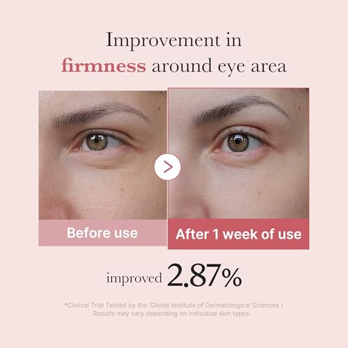 medicube Salmon DNA PDRN Pink Peptide Eye Serum with Niacinamide and 99% Purity Retinol for Fine Lines, Uneven Skin Tone, Korean Skin Care 1.01fl.oz