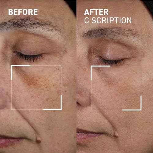 Dr. Brandt Bright This Way C Scription - Concentrated Vitamin C Serum - Fade Dark Spots, Reduce Wrinkles & Illuminate Skin Tone - 1 fl oz