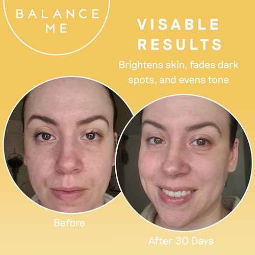 Balance Me Vitamin C Repair Serum, With Hyaluronic Acid, Reduce Age Spots & Hyperpigmentation, Anti-Ageing & Hydrating?Face Serum?? 100% Natural, Vegan & Cruelty Free, Made?in?UK, 1.01 Fl Oz