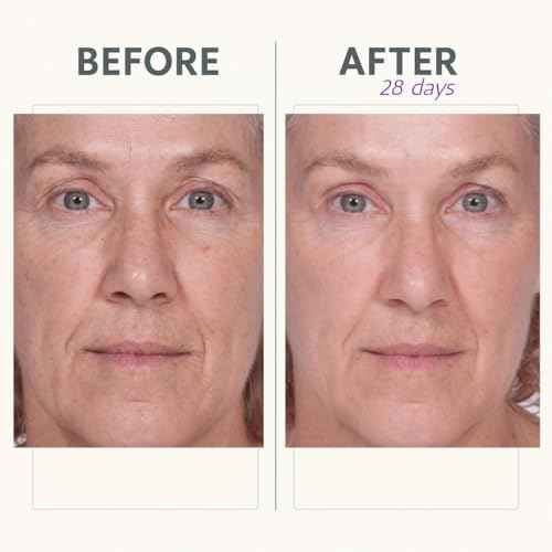 Reverse Lift Firming Facial Serum, Visibly Firm, Tone & Tighten Skin, Hydrating Anti-Aging Peptides, Reduce Wrinkles, Sagging Face and Neck, Serious Skincare, 1 oz