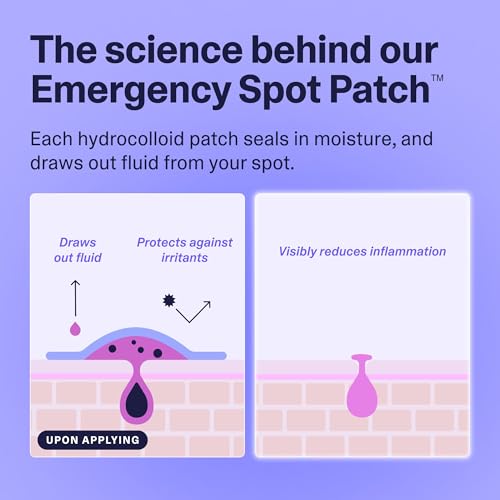 Curology Emergency Spot Pimple Patches for Face, Stocking Stuffer Gifts, Hydrocolloid Pimple Patches Fast-Acting, 80 Count