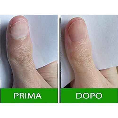 Pantogar (Pantovigar) Specific Treatment for Hair and Nails - 90 Cap