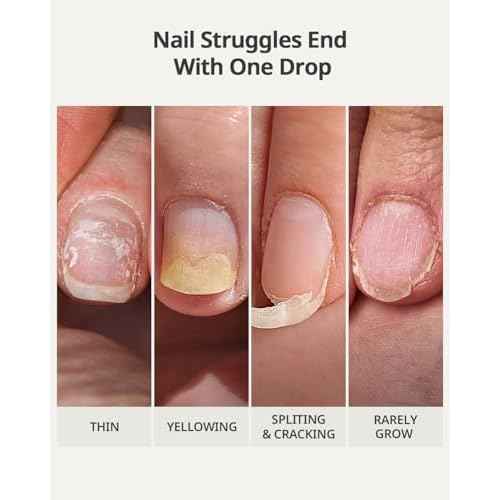 BTARTBOXNAILS Naillush Nail Strengthener & Growth - Repair Damaged Nails, Strengthen Weak & Thin Nails, Extra Strong Nail Growth Treatment, Long Lasting Nail Hardener, 15ml