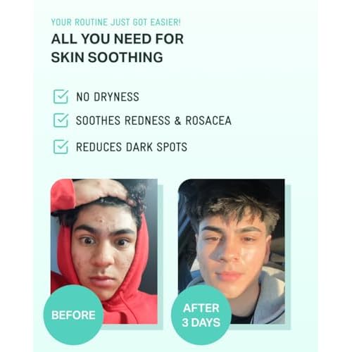 BRING GREEN ZINC TECA Serum with Niacinamide | Soothing Face Serum for Sensitive Skin, Pore Minimizing & Hydrating | Korean Skincare for Breakouts & Uneven Texture