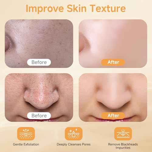 Peel Shot Glow Rice Ampoule, Black and White Rice Exfoliant for Face and Body, Rice Exfoliator for Faces Dead Skin Cells Remover, Face Peel Shot Serum for Softens Cuticle, 80ML (White Rice)