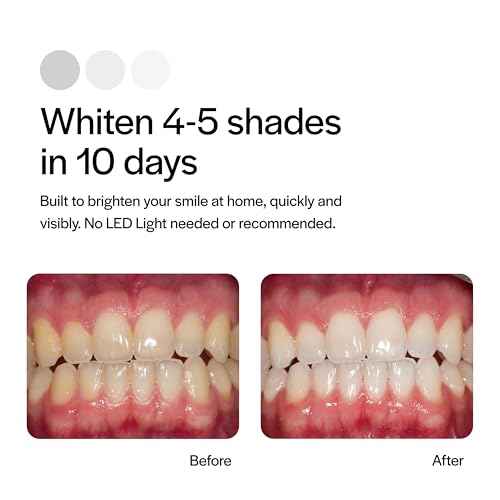 Opalescence Go 15% Mint - Prefilled Teeth Whitening Trays - 4 Treatments (2 Packs) - Made by Ultradent. 4648-2